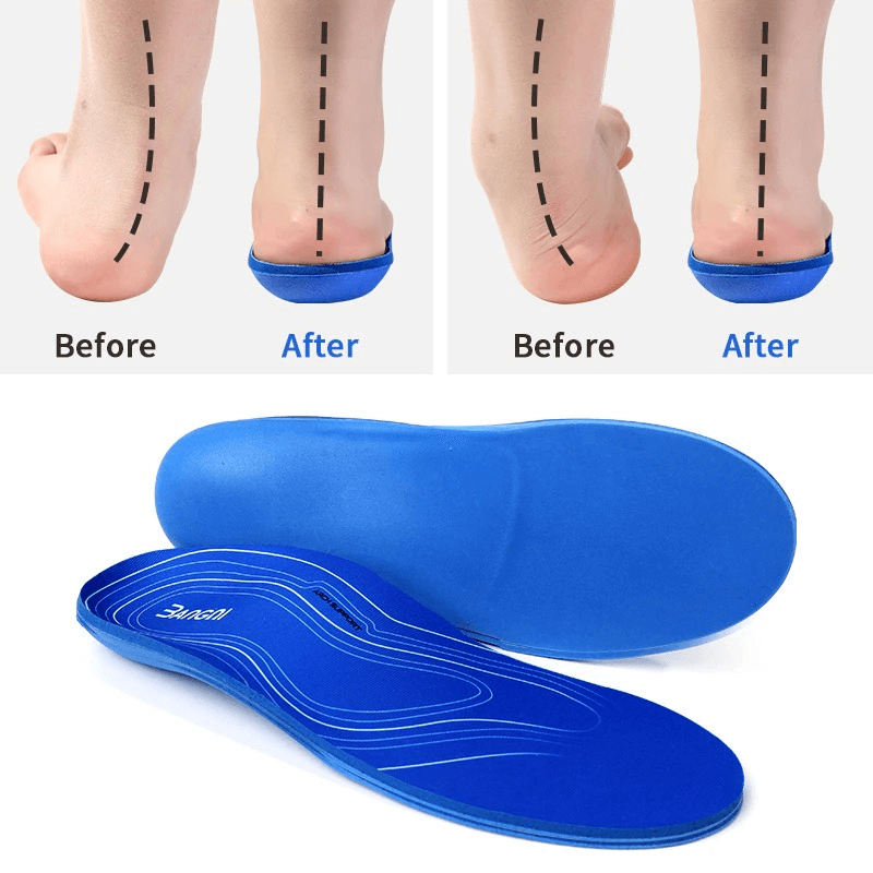 Orthopedic insoles for shoes showing before and after foot alignment with blue EVA design for flat feet support.